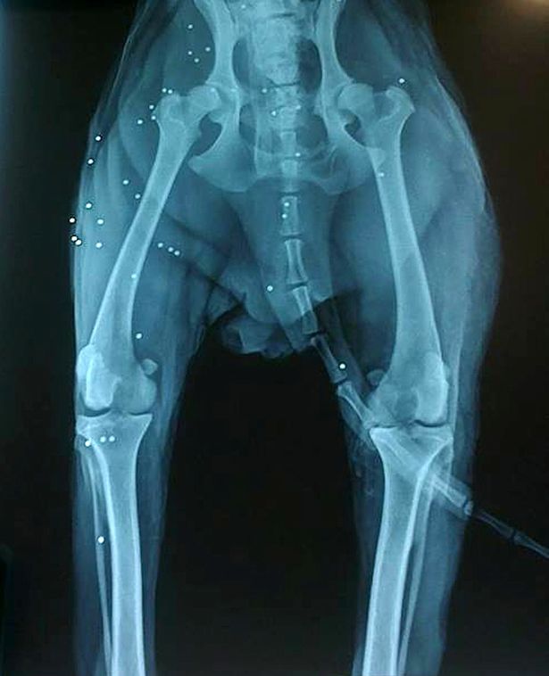 An x-ray showing his 38 bullet wounds