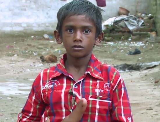 Indian boy with rare case of gigantism hopes to live normal life (pics ...