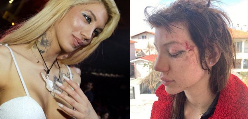 Greek porn star: I was stripped and brutally beaten by a gang of women  (photos) | protothemanews.com